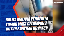 Balita Malang Penderita Tumor Mata di Lampung, Butuh Bantuan Donatur