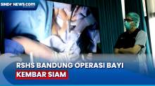 Usai Jalani Operasi Pemisahan, 1 Bayi Kembar Siam Meninggal di RSHS Bandung