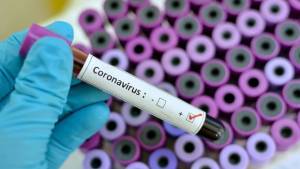 Berupaya Boyong 290 Juta Vaksin Covid-19, Luhut Tebar Semangat Optimisme
