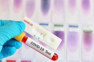Mau Rapid Test Antigen? Ini Daftar Harganya di Wilayah Jabodetabek