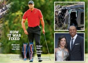 Tiger Woods Gemparkan Dunia: Rekor Masters, Kecelakaan, Skandal Cinta
