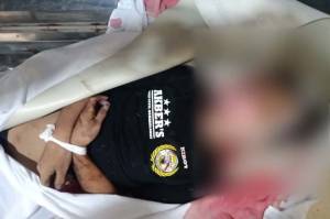 Jatuh dari Mobil Pikap di Ciledug Tangerang, Pria Berkaus AKBERS Tewas Mengenaskan