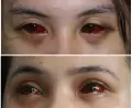 Viral, Penampakan Mata Merah Suporter Cantik Arema Efek Tembakan Gas Air Mata Kedaluwarsa