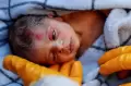 Bayi Usia 20 Hari Ini Selamat dari Reruntuhan Gempa Dahsyat di Turki