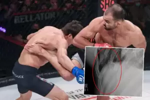 Brutal! 5 Tulang Rusuk Petarung MMA Patah Disodok Tendangan Putar