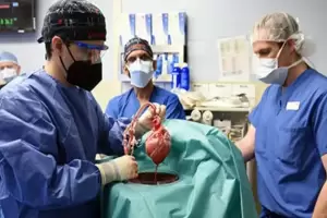 Dokter Selidiki Misteri Kematian Pria Pertama Penerima Transplantasi Jantung Babi