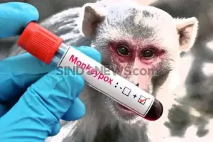 Hasil PCR Pasien Suspek Cacar Monyet di Jateng Negatif, Ini Kata Kemenkes