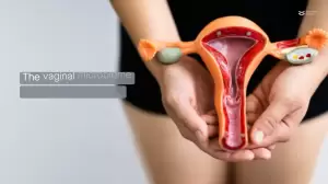 Cegah Keputihan, Ilmuwan Berhasil Kembangkan Chip Vagina