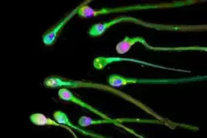 Penemuan Baru, Gelombang Ultrasonik Mampu Dongkrak Kemampuan Sperma